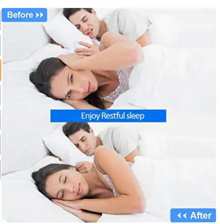 Premium Anti Snoring Device Anti Spier