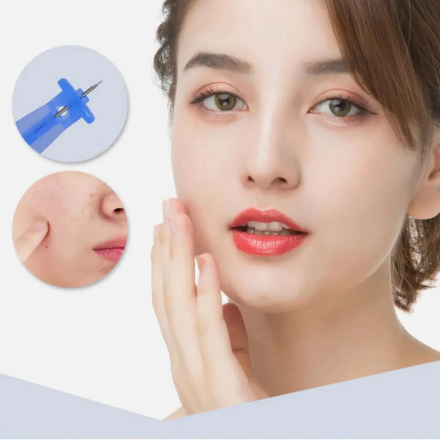 Professional 50pcs Disposable Blackhead and Blemish Remover Tools for Acne, Whitehead, Comedone Removal - Pimple Popper Set for Salon and Home Use Anti Spier