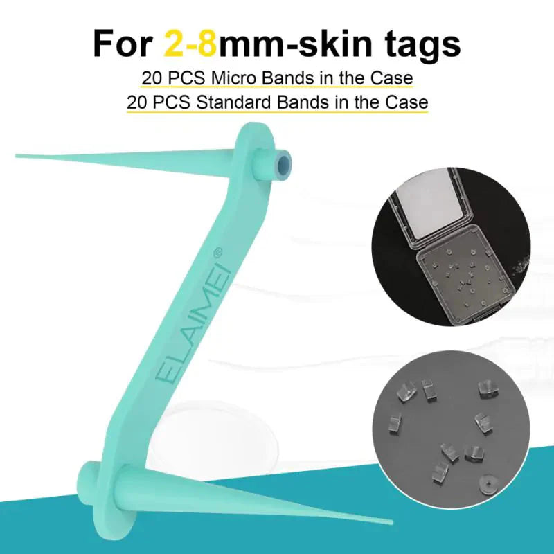 Auto Skin Tag Remover Kit Anti Spier