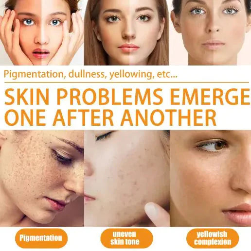 Vitamin C Serums Anti Spier