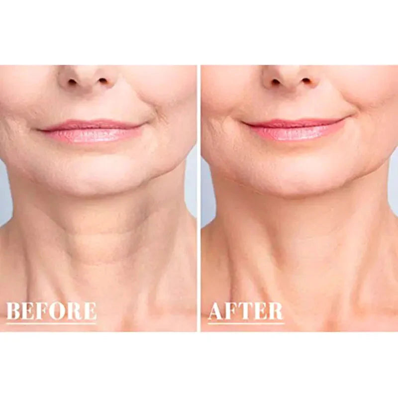 Reusable Anti Wrinkle Chest Anti Spier