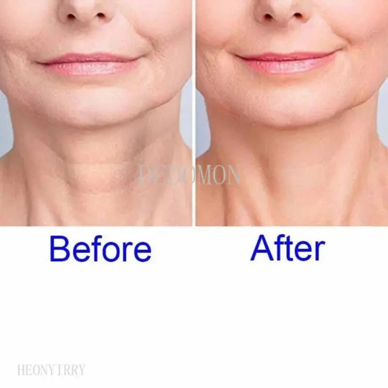 Silicone Anti-Wrinkle Pad Anti Spier