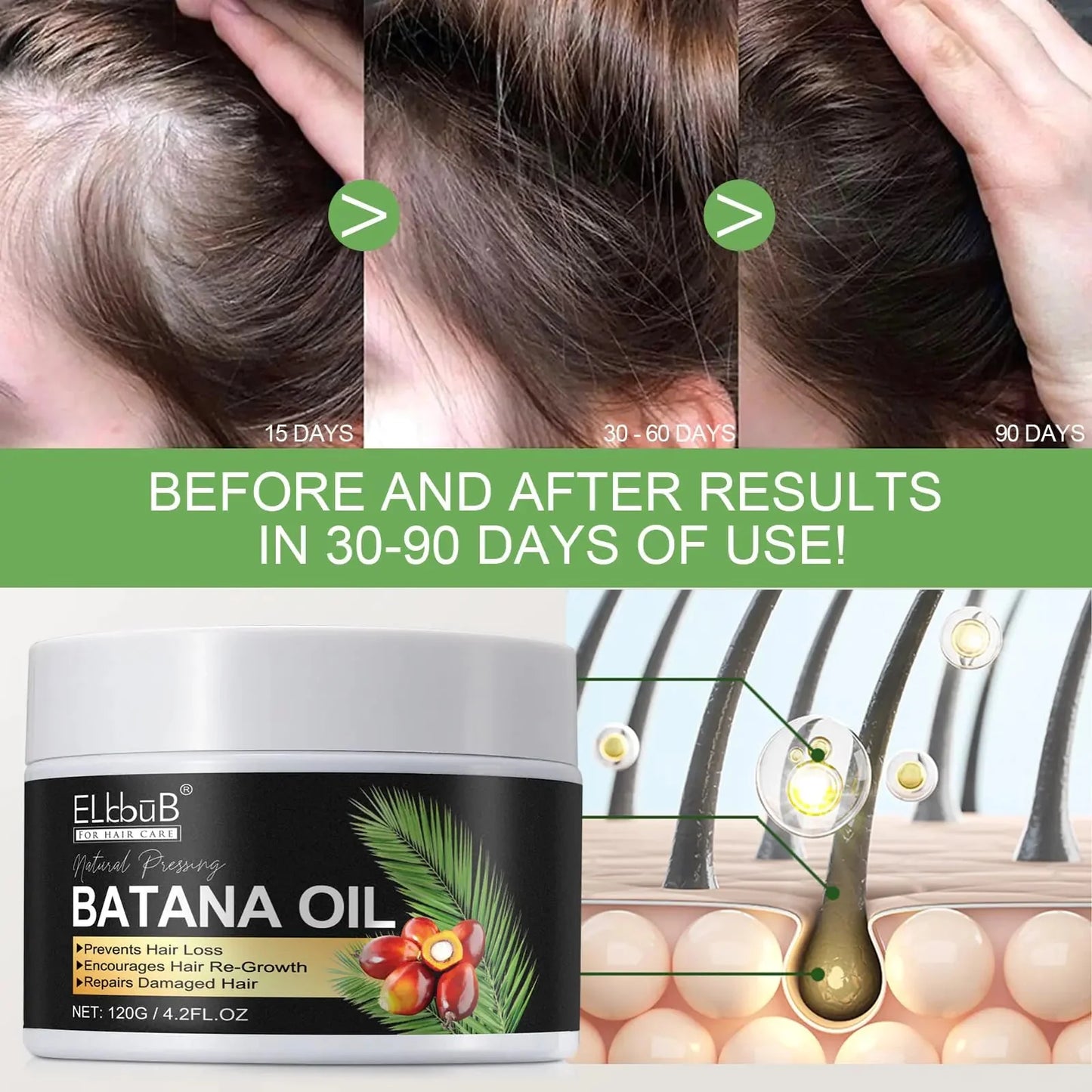 Raw Batana Oil for Hair Growth and Repair -100% Pure, Unrefined Oil from Honduran Rainforests Prevent Hair Loss and Enhances Hair Thickness in Men & Women 4.2 Fl Oz (Pack of 1) Anti Spier